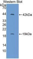 IL1R1 Antibody (aa20-338)