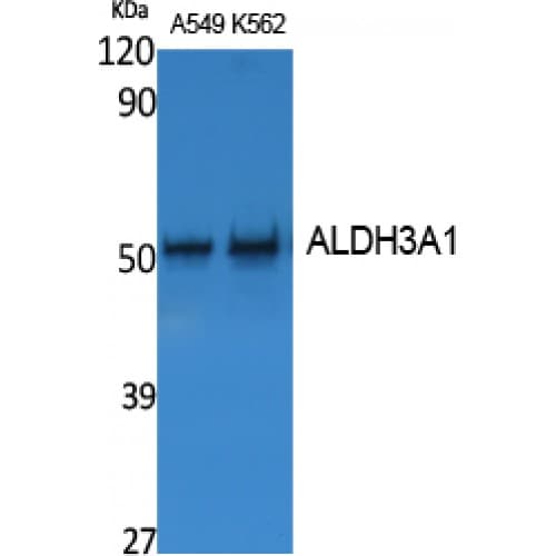 Polyclonal Rabbit anti-Human ALDH3A1 Antibody (Internal, WB)