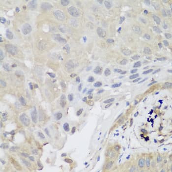 SH3GLB2 / Endophilin-B2 Antibody
