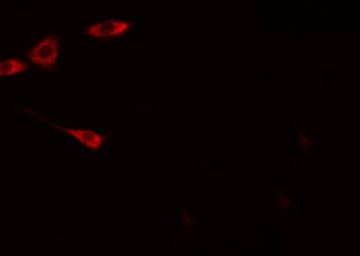 ARFGAP1 Antibody