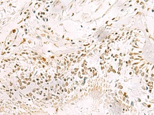 Polyclonal Rabbit anti-Human PDS5A Antibody (IHC)