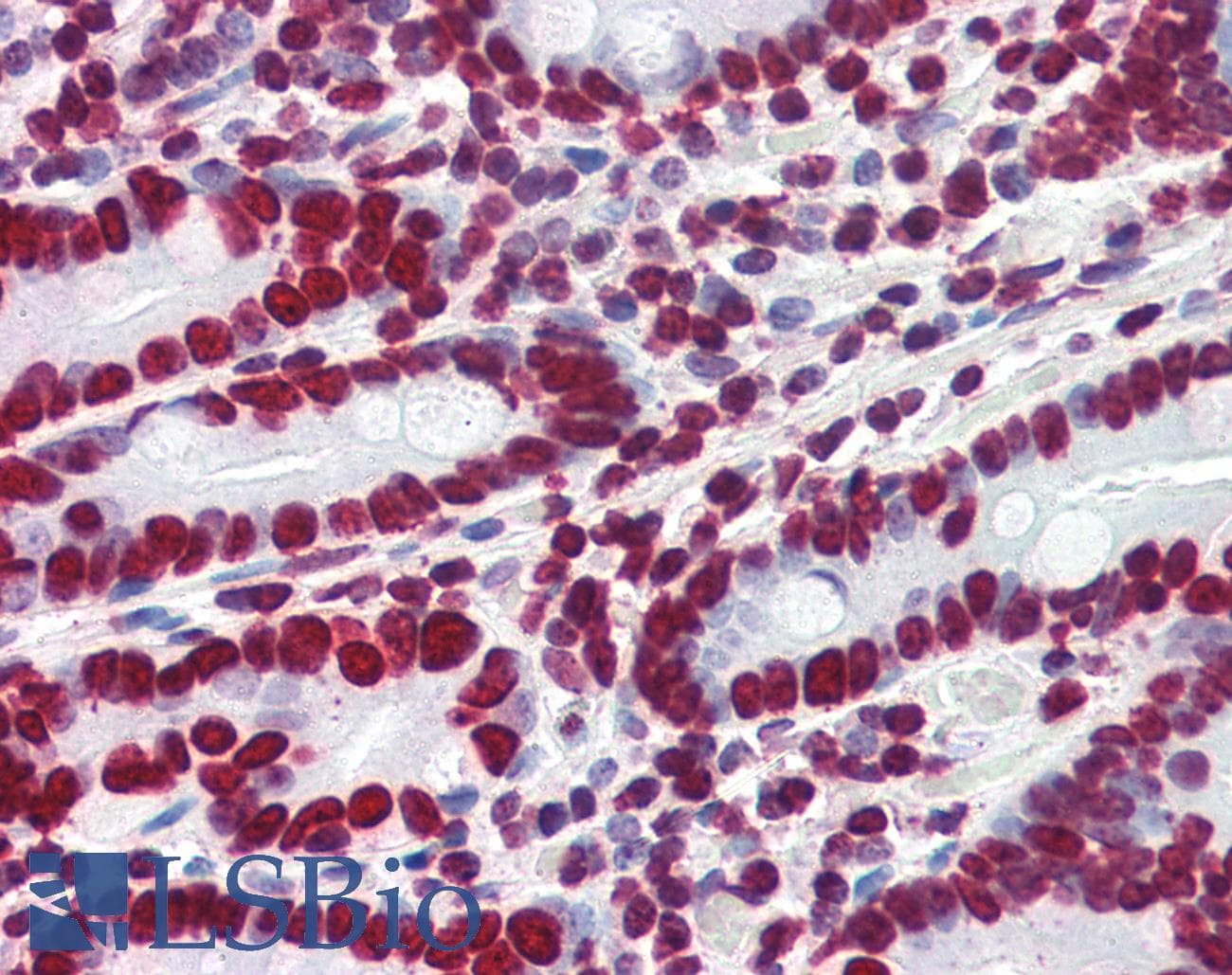 IHC-plus™ HMGIY / HMGA1 Antibody (aa12-23)