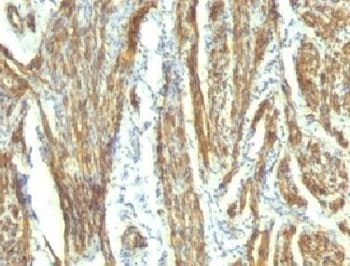 CALD1 / Caldesmon Antibody (clone CALD1/820 + h-CALD)
