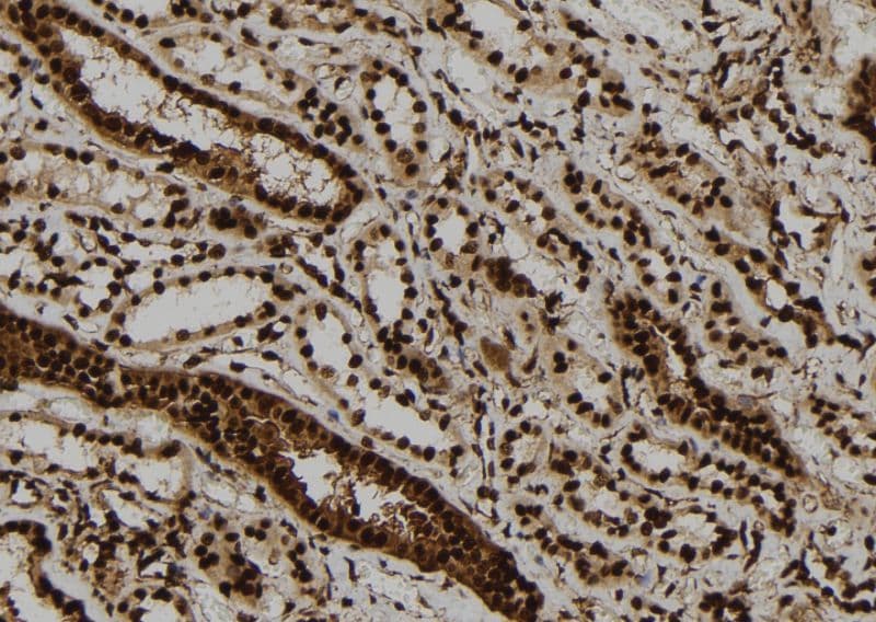 ULK2 Antibody
