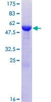 Human ETFB Protein (Recombinant GST)