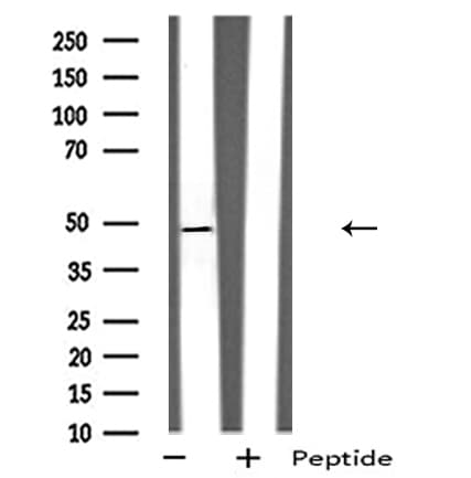 RAIG2 / GPRC5B Antibody