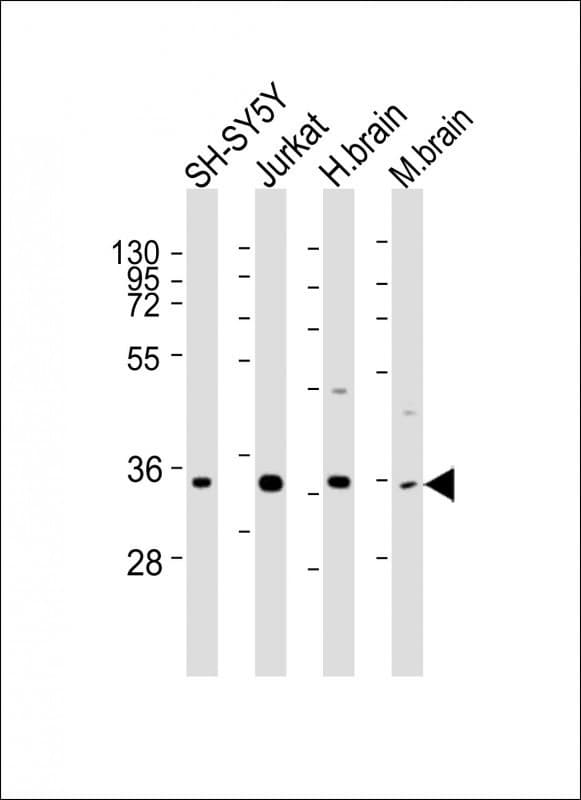 RASSF2 Antibody (aa123-156)