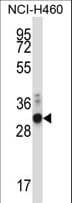 ZFPL1 Antibody (aa191-219)