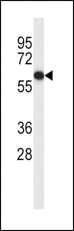 ER Alpha / Estrogen Receptor Antibody (aa246-273)