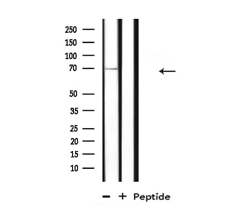 GUCY1B3 Antibody