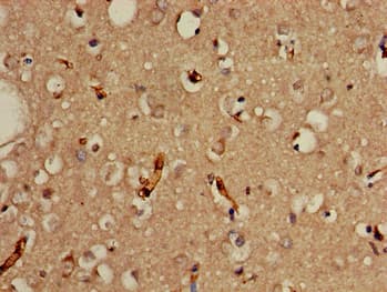 PRDM2 / RIZ1 Antibody
