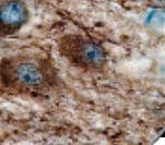 Neurofilament Antibody (clone 2F11, Ready-to-Use)