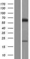 ME2 / Malate Dehydrogenase 2 Protein (Over-Expression Lysate Myc-DDK (Flag))