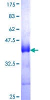 Human CD320 Protein (Recombinant GST, N-terminus)