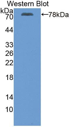 ATP2A2 / SERCA2 Antibody (aa315-756)