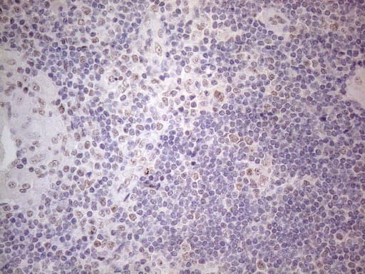 IRS1 Antibody (aa1-280, clone OTI2B10)