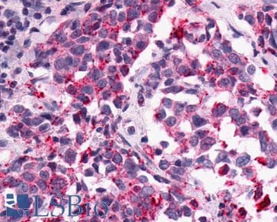 PathPlus™ Polyclonal Rabbit anti-Human GPR1 Antibody (C-Terminus, IHC)