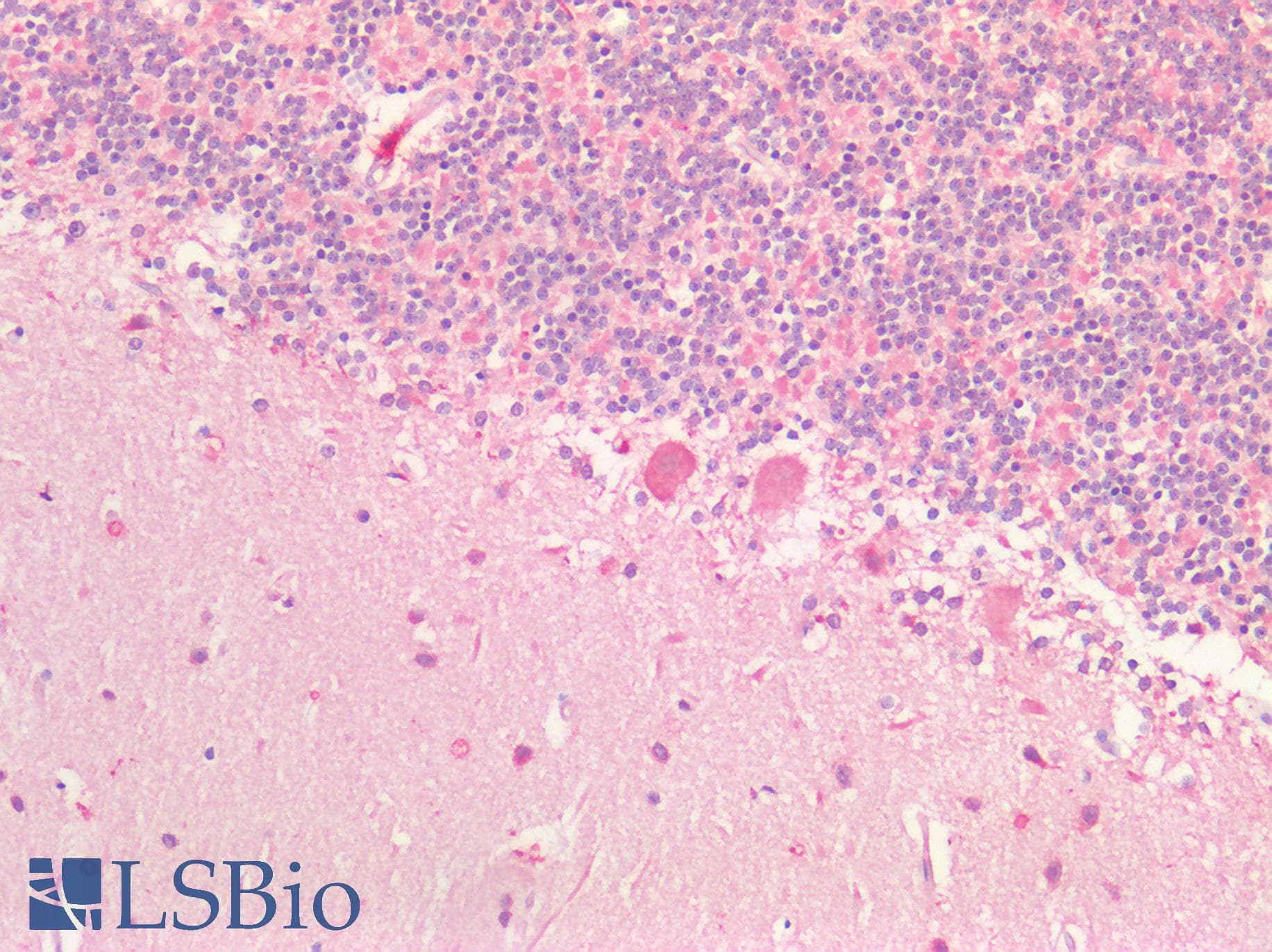 PathPlus™ BDNF Antibody