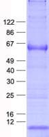 Human MAGEC2 / CT10 Protein (Recombinant His, N-Terminal)