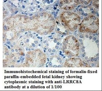 LRRC8A / LRRC8 Antibody (aa648-803)