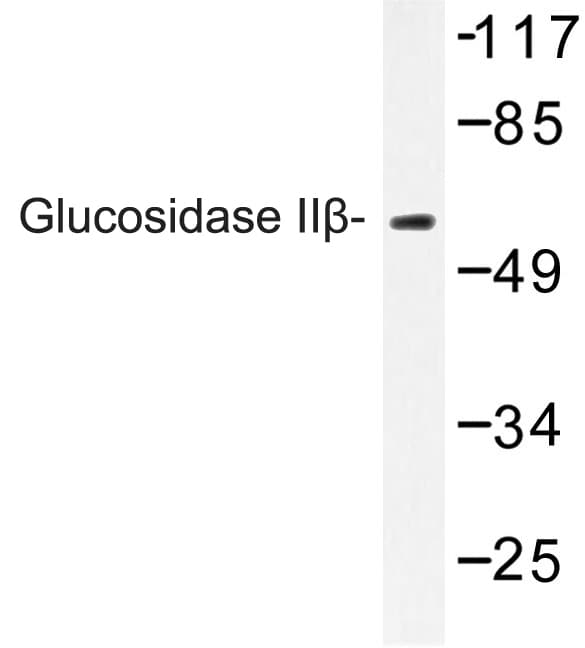 PRKCSH Antibody (Lys117)