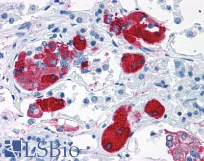 PathPlus™ CRHR2 / CRF2 Receptor Antibody (N-Terminus)