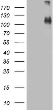CDH4 / R Cadherin Antibody (aa170-428, clone OTI1B7)