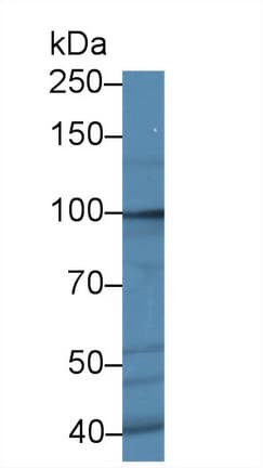 ROR2 Antibody (aa683-934)