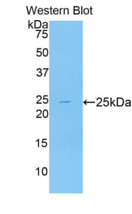 NPEPPS Antibody (aa584-755, PE)