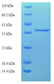 Human MLXIP / MONDOA Protein (Recombinant His-SUMO)