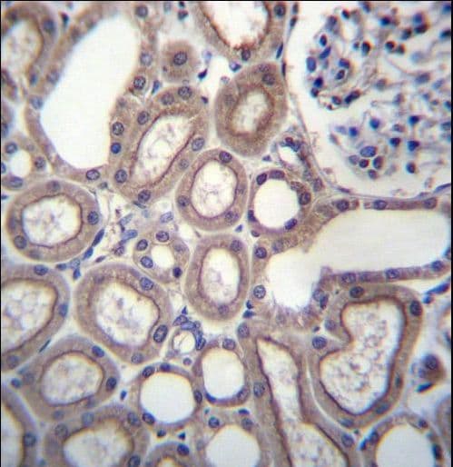 Polyclonal Rabbit anti-Human RNF180 Antibody (aa401-430, IHC, WB)