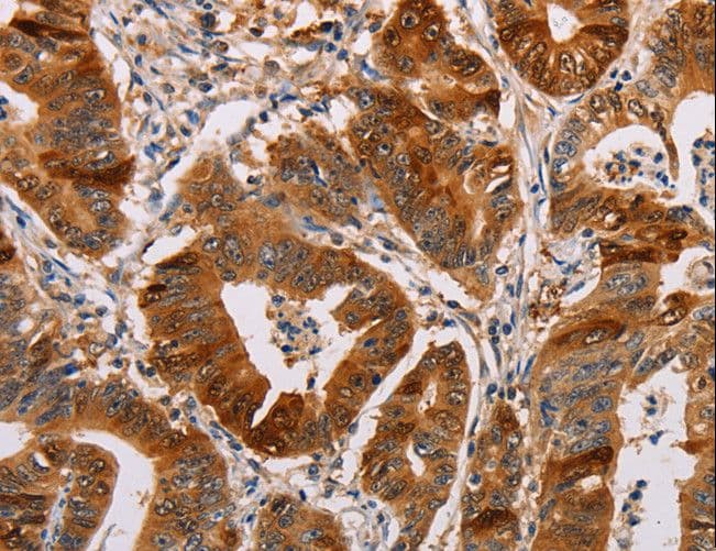 ALDH3A1 Antibody