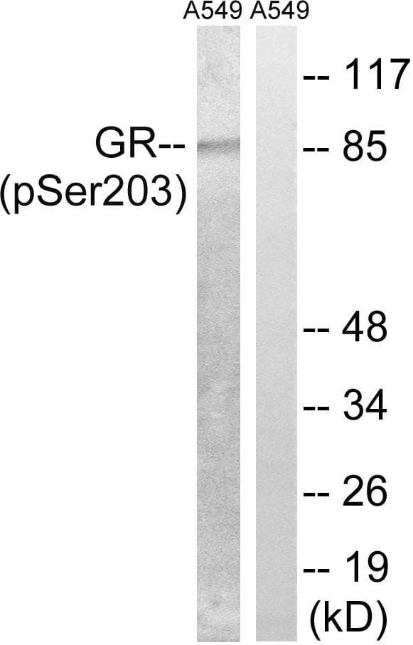 NR3C1/Glucocorticoid Receptor Antibody (phospho-Ser203)