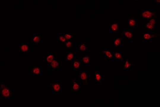 DLX3 Antibody (aa87-137)