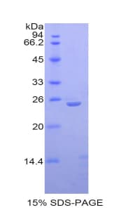 Rat IL27 Protein (Recombinant His)