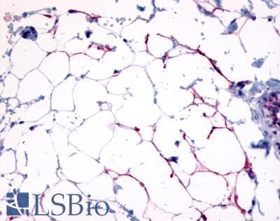 IHC-plus™ Polyclonal Rabbit anti-Human HCAR3 / GPR109B / HM74 Antibody (N-Terminus, IHC)