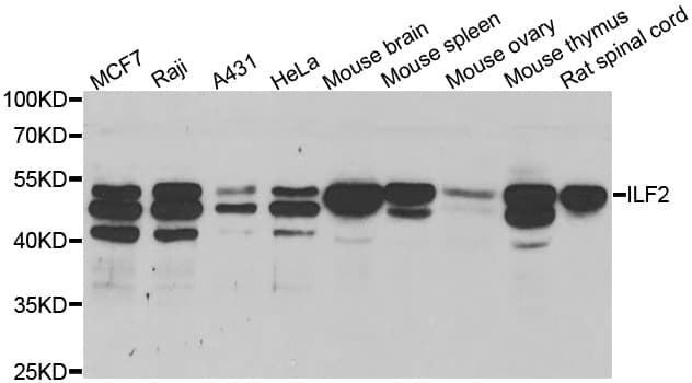 Polyclonal Rabbit anti-Human NF45 / ILF2 Antibody (IHC, IF, WB)