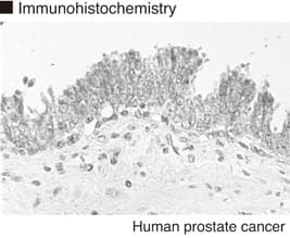Monoclonal Mouse anti-Human FHL2 Antibody (clone 11-134, IHC, WB)