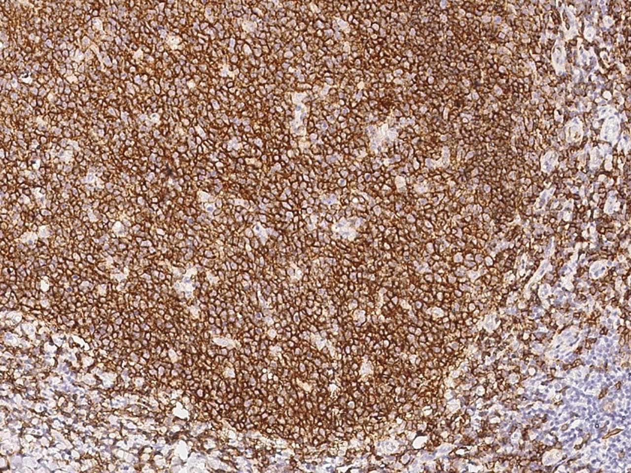 CD19 Antibody (aa1-291, clone 25, Preservative Free)