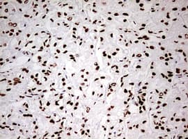 Monoclonal Mouse anti-Human HNRPM / HNRNPM Antibody (clone OTI3F3, aa1-261, IHC, WB)