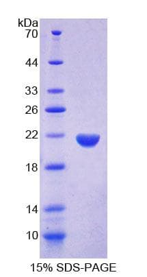 Rat FAP-1 / PTPN13 Protein (Recombinant His-T7, N-terminus)