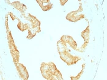 Pan Cytokeratin Antibody (clone KRT/457, Ready-to-Use)