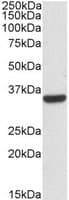 IHC-plus™ CNN2 Antibody (aa292-306)