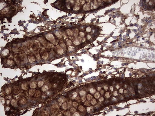 LGALS3 / Galectin 3 Antibody (clone OTI1C7)