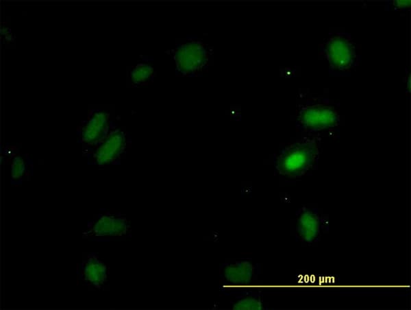 OXSR1 / OSR1 Antibody (clone 3A8)
