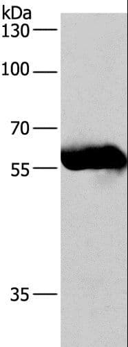 Polyclonal Rabbit anti-Human CORO1C Antibody (IHC, WB)