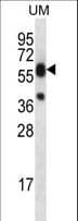 LIPM / LIPL3 Antibody (aa318-346)