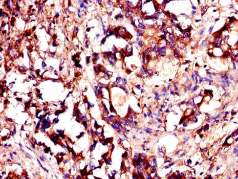 YES1 / c-Yes Antibody