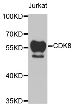 Polyclonal Rabbit anti-Human CDK8 Antibody (IHC, WB)