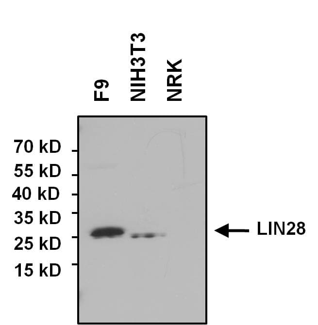 IHC-plus™ Polyclonal Rabbit anti-Human LIN28A / LIN28 Antibody (IHC, IF, WB)